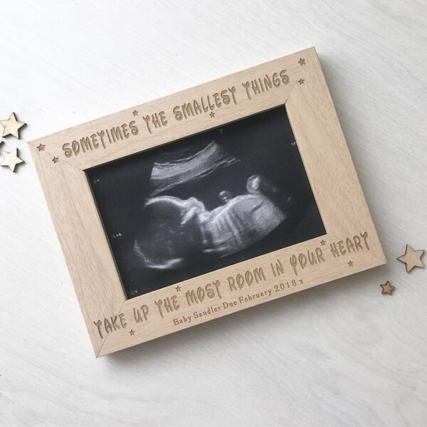 Sometimes The Smallest Things Baby Bump Scan Frame