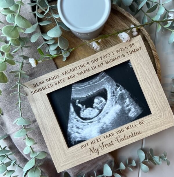 My First Valentine 2025 Baby Bump Scan Frame - Image 2