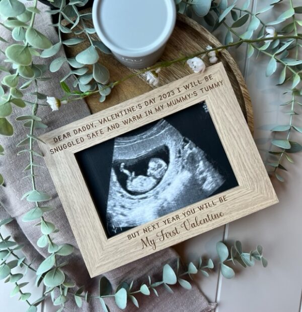 My First Valentine 2025 Baby Bump Scan Frame
