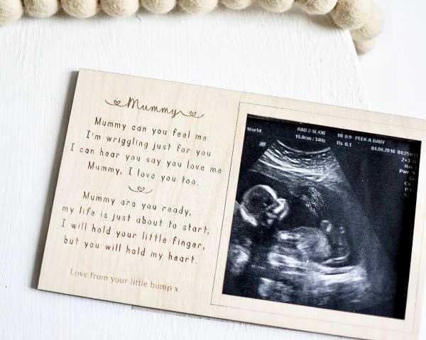 Mummy To Be Personalised Magnet Scan Frame Decoration