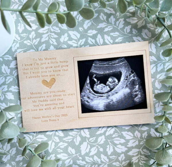 2025 EDITION Mummy To Be MOTHER'S DAY Magnet Scan Frame - Image 2