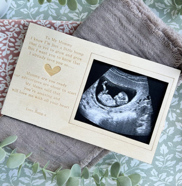 Mummy & Mummy Magnet Scan Frame Decoration - Image 3