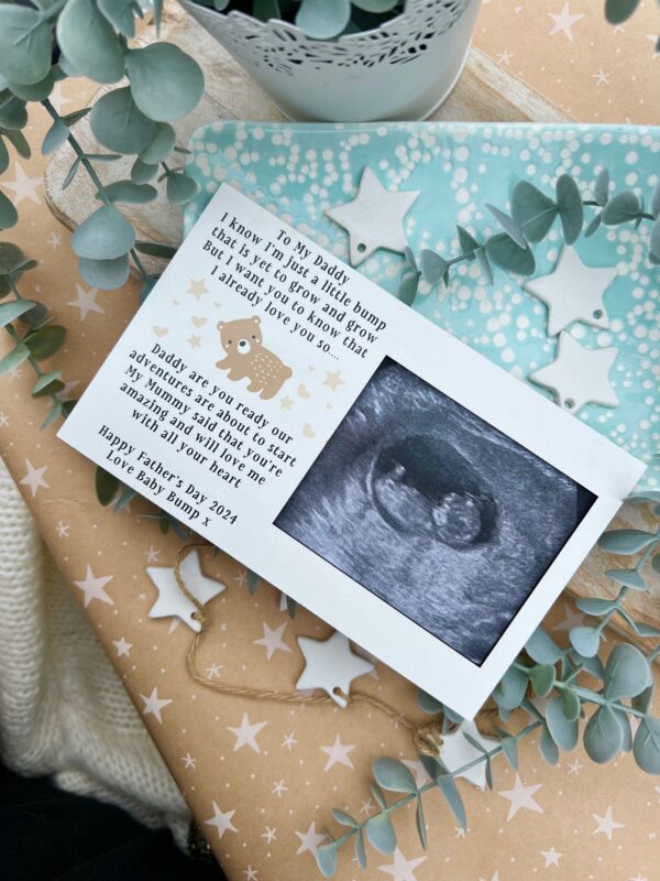 I Already Love You So Daddy To Be Father's Day 2025 Magnet Scan Frame (PR) - Image 5