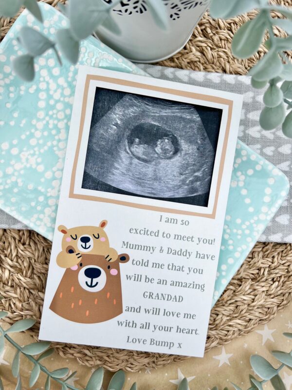 Grandparent To Be See You Soon Magnet Scan Frame (PR) - Image 2