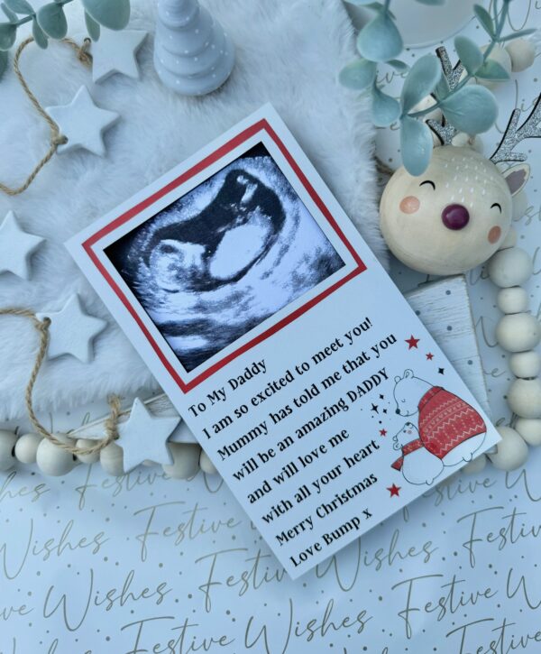 My Amazing Daddy To Be Scan Frame Decoration (PR) - Image 2