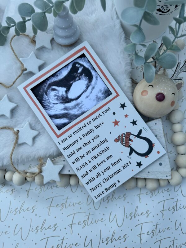 My Amazing Grandparents To Be Scan Frame Decoration (PR) - Image 3