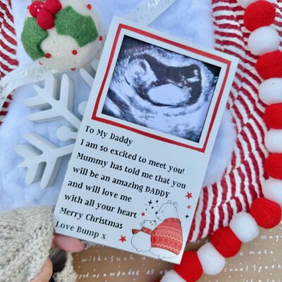 My Amazing Daddy To Be Scan Frame Decoration (PR)