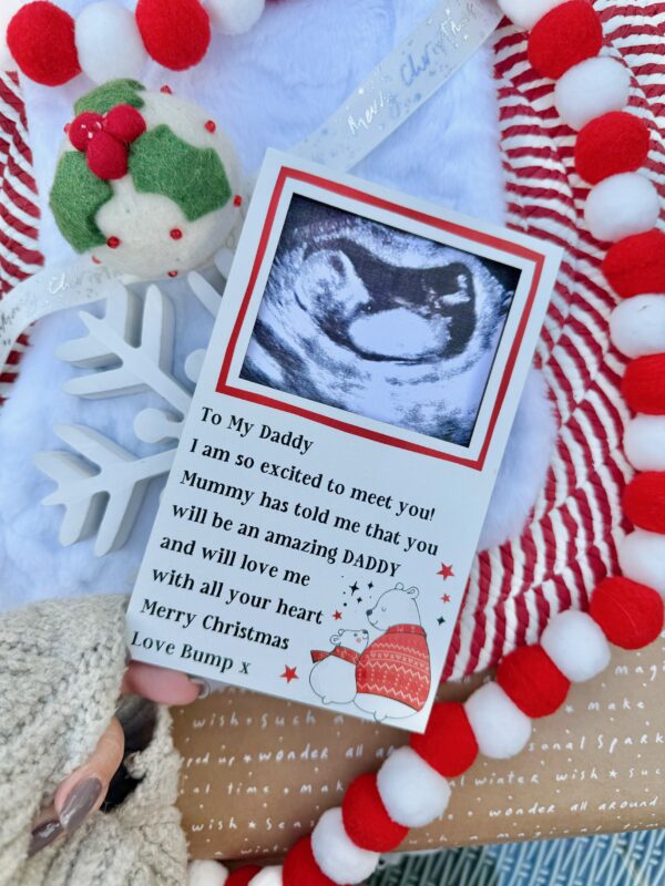 My Amazing Daddy To Be Scan Frame Decoration (PR)