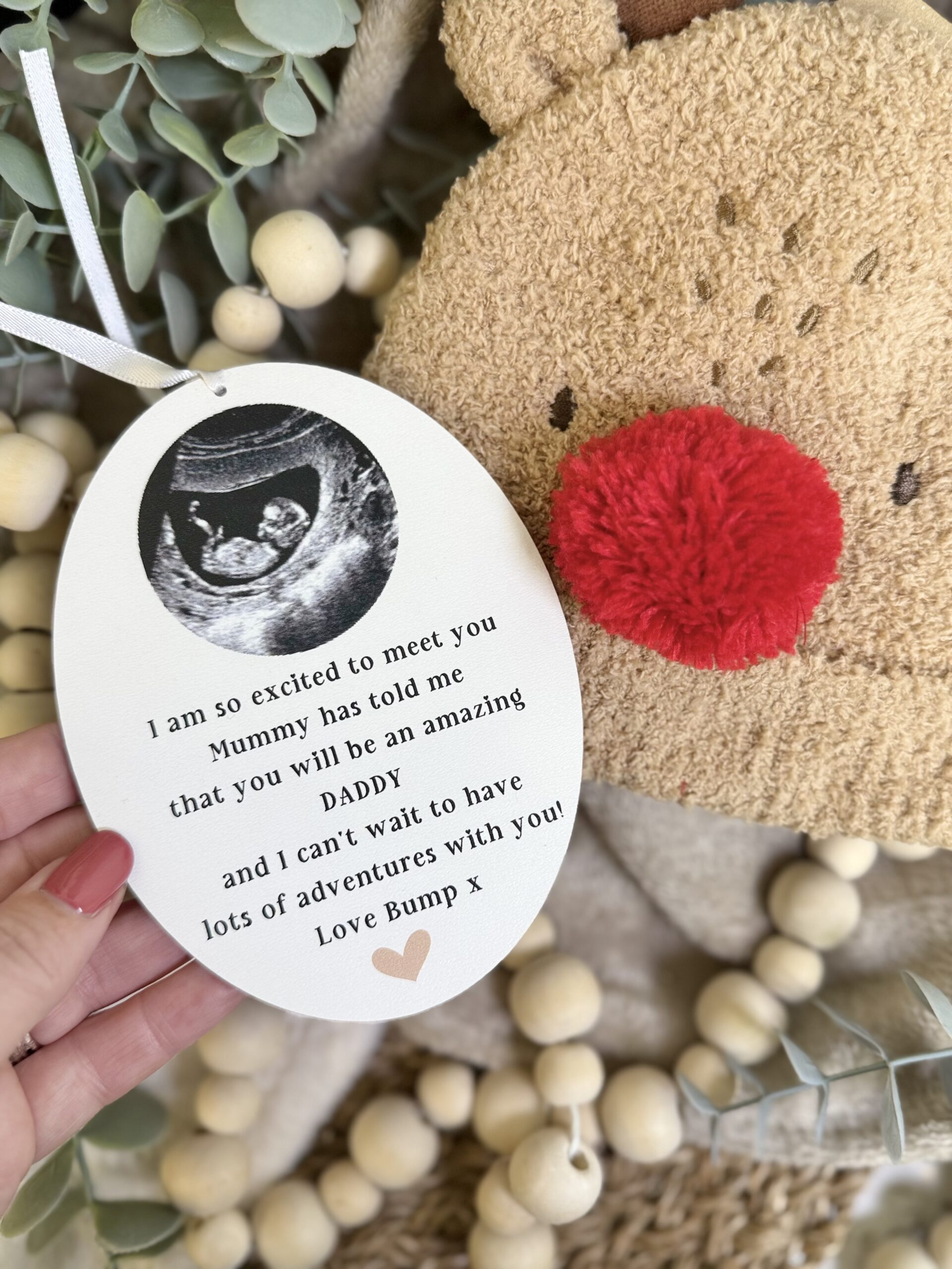 ADD Your Own Scan Picture DADDY To Be Christmas Decoration (PR) 3