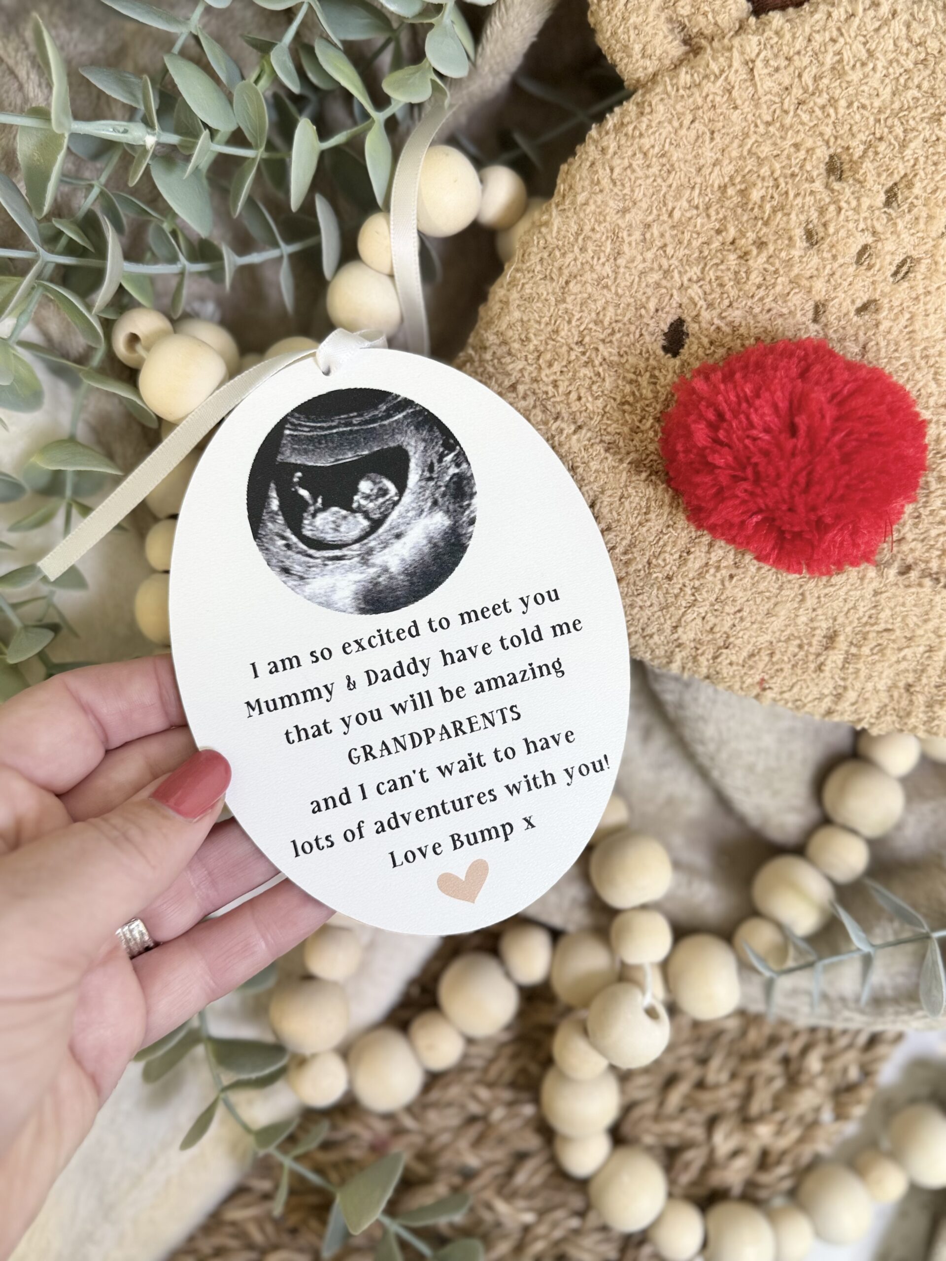 ADD Your Own Scan Picture GRANDPARENTS To Be Christmas Decoration (PR) 1
