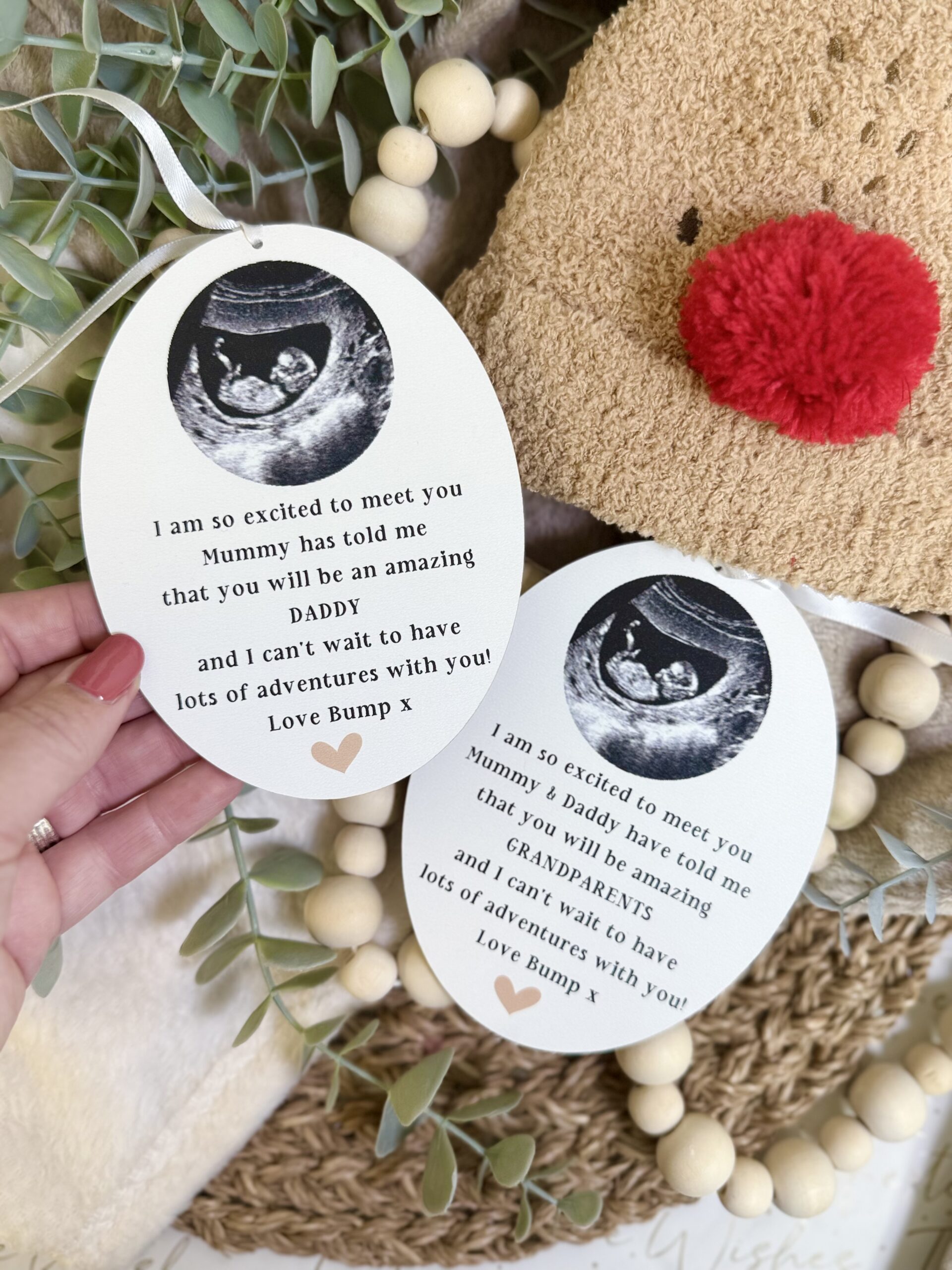 BOTH ADD Your Own Scan Picture DADDY GP To Be Christmas Decoration (PR)