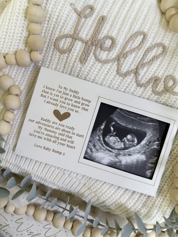 Magnet Scan Frame Decoration Daddy To Be Gift From Bump (WH) 2