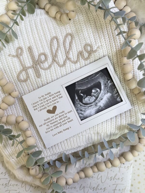 Magnet Scan Frame Decoration Daddy To Be Gift From Bump (WH) 3