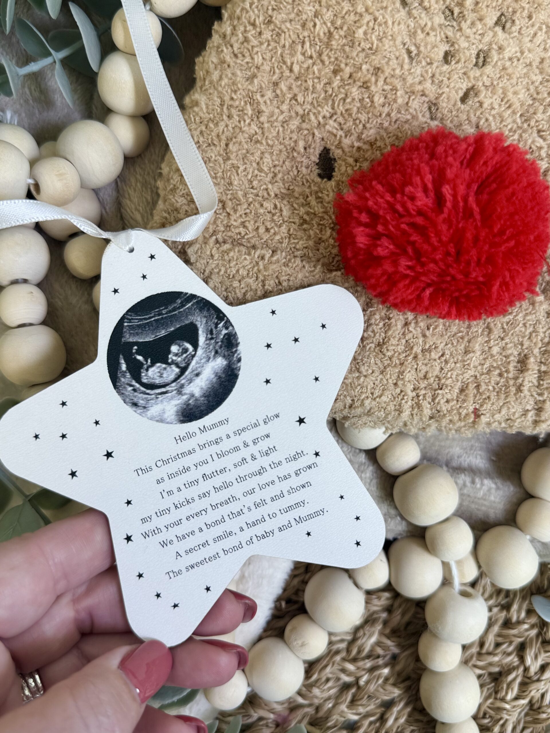 Sweetest Bond Baby & Mummy To Be Scan Photo Decoration (PR) 1