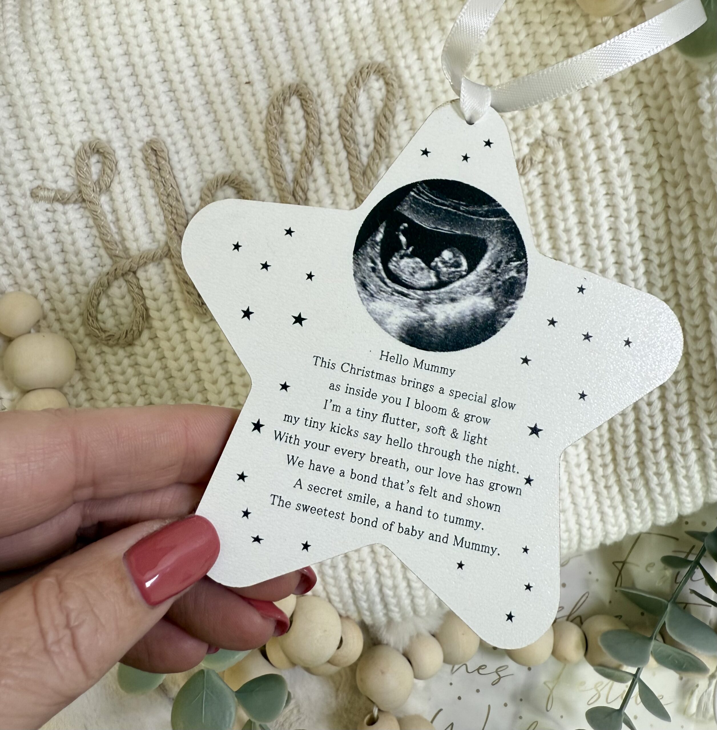 Sweetest Bond Baby & Mummy To Be Scan Photo Decoration (PR) 3